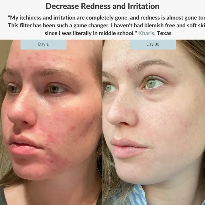 Filterbaby Skincare Filter 1.0 white - Hollow Way Home